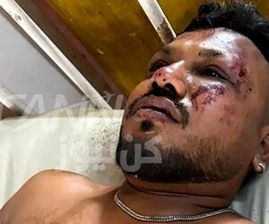 معجزه نجات! سقوط بویینگ ۷۸۷ ایرایندیا یک بازمانده داشت